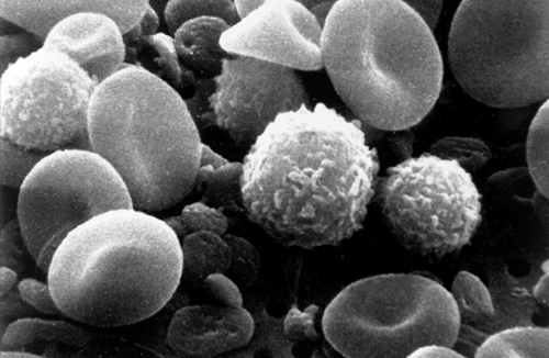 Krew pod mikroskopem fot. National Cancer Institute
